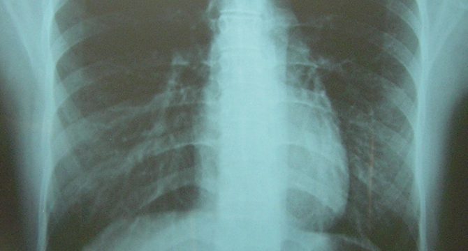 日本酒に合う太りにくいおつまみの選び方を示すイメージ